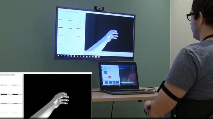 virtual reality to combat phantom pain 